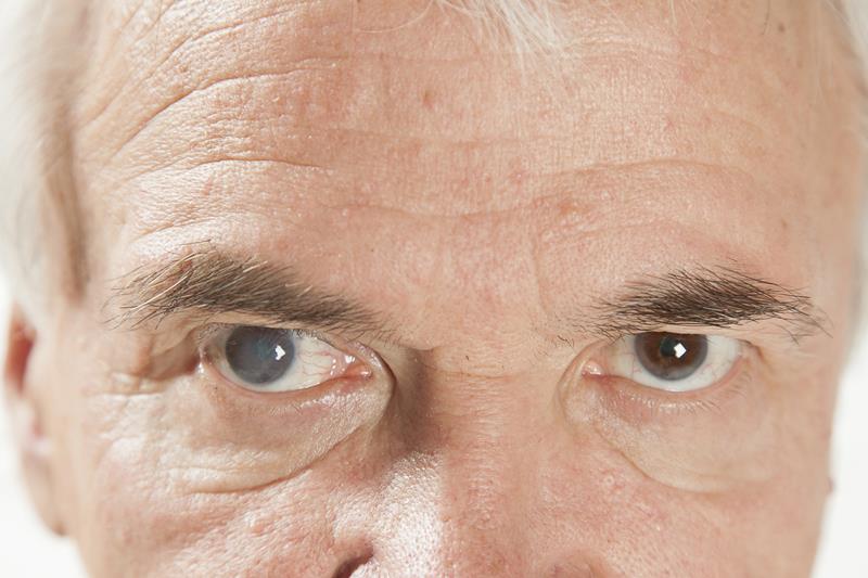 Cataract eye surgery